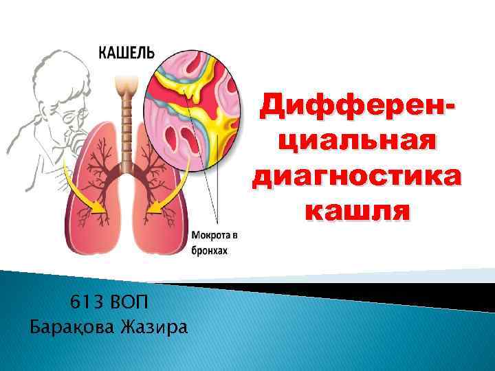 Дифференциальная диагностика кашля 613 ВОП Барақова Жазира 