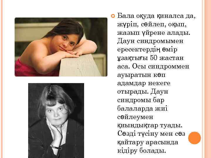  Бала оқуда қиналса да, жүріп, сөйлеп, оқып, жазып үйрене алады. Даун синдромымен ересектердің