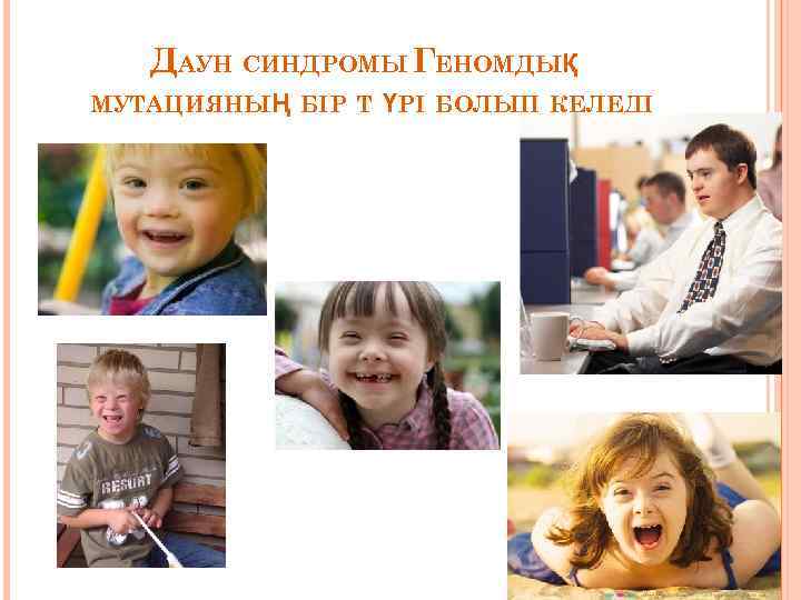 ДАУН СИНДРОМЫ ГЕНОМДЫҚ МУТАЦИЯНЫҢ БІР Т ҮРІ БОЛЫП КЕЛЕДІ 