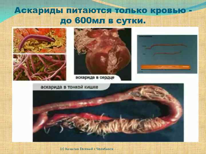 Аскариды питаются только кровью до 600 мл в сутки. (с) Кичигин Евгений г. Челябинск
