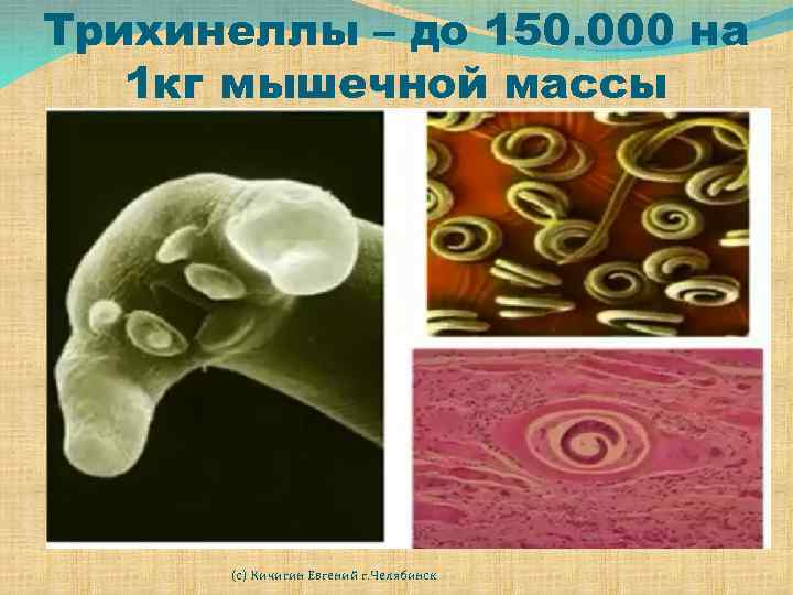 Трихинеллы – до 150. 000 на 1 кг мышечной массы (с) Кичигин Евгений г.