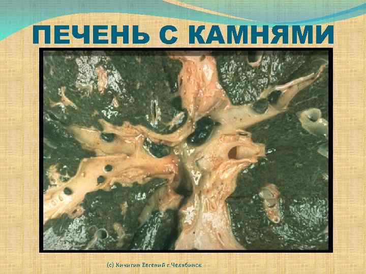  ПЕЧЕНЬ С КАМНЯМИ (с) Кичигин Евгений г. Челябинск 