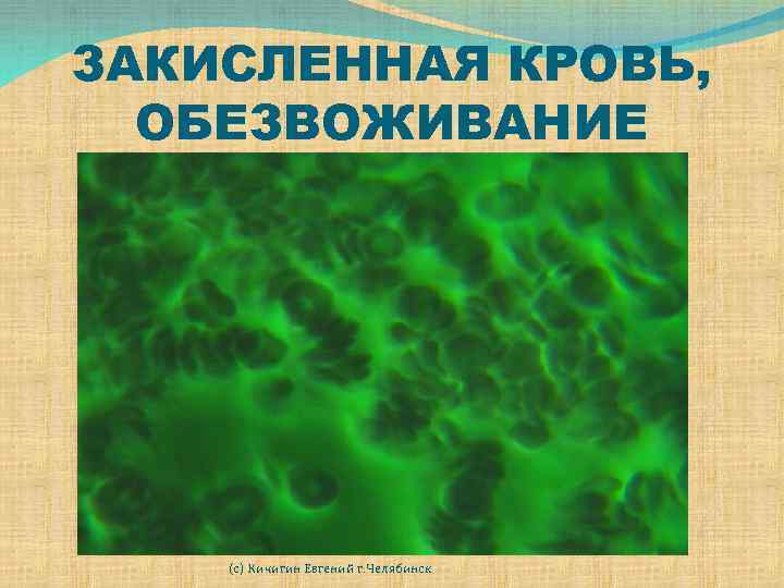 ЗАКИСЛЕННАЯ КРОВЬ, ОБЕЗВОЖИВАНИЕ (с) Кичигин Евгений г. Челябинск 