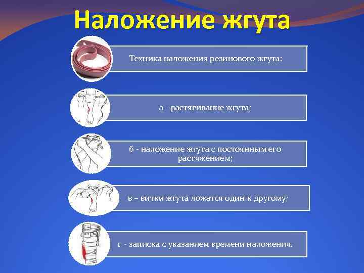 Наложение жгута Техника наложения резинового жгута: а - растягивание жгута; б - наложение жгута