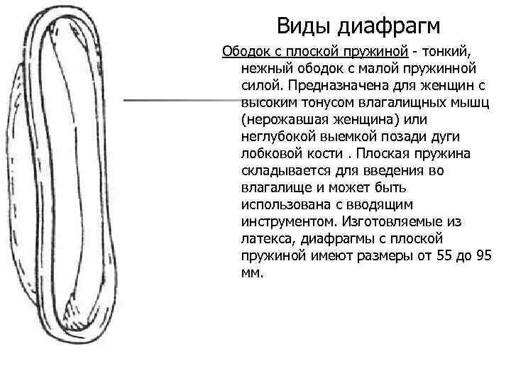 Виды диафрагм Ободок с плоской пружиной - тонкий, нежный ободок с малой пружинной силой.