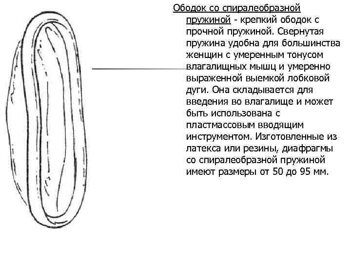 Ободок со спиралеобразной пружиной - крепкий ободок с прочной пружиной. Свернутая пружина удобна для