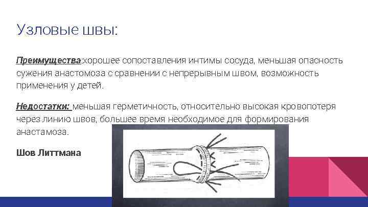 Узловые швы: Преимущества: хорошее сопоставления интимы сосуда, меньшая опасность сужения анастомоза с сравнении с