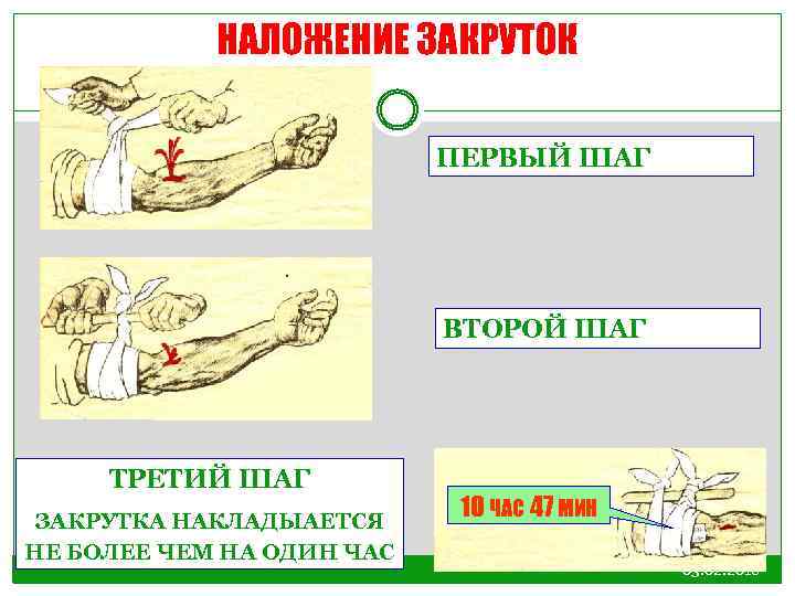 НАЛОЖЕНИЕ ЗАКРУТОК ПЕРВЫЙ ШАГ ВТОРОЙ ШАГ ТРЕТИЙ ШАГ ЗАКРУТКА НАКЛАДЫАЕТСЯ НЕ БОЛЕЕ ЧЕМ НА