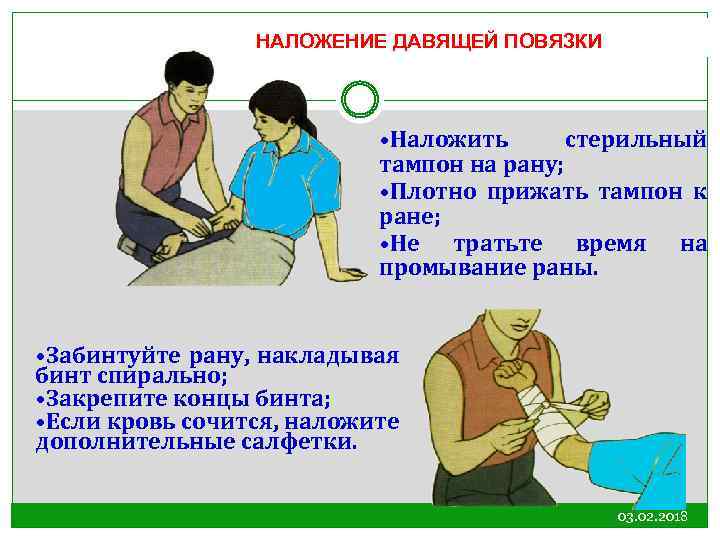 НАЛОЖЕНИЕ ДАВЯЩЕЙ ПОВЯЗКИ • Наложить стерильный тампон на рану; • Плотно прижать тампон к