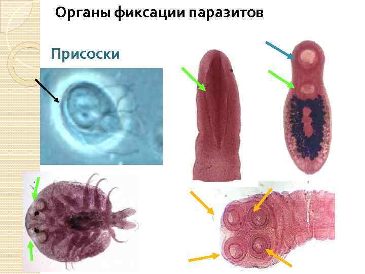 Органы фиксации паразитов Присоски 