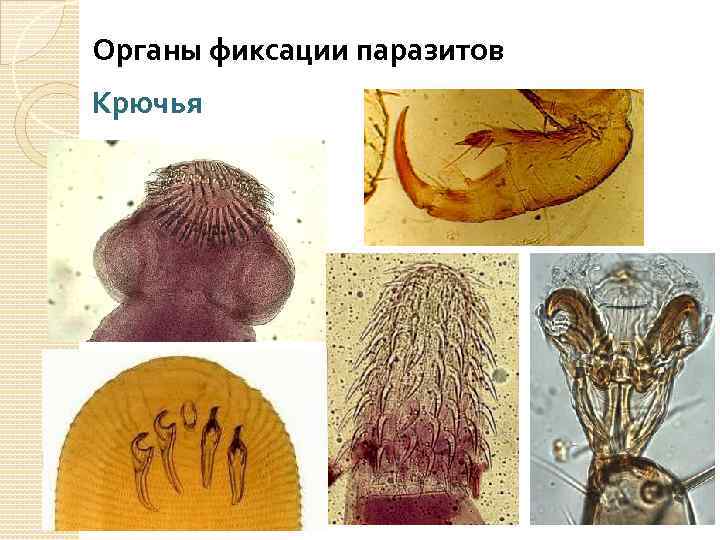 Органы фиксации паразитов Крючья 