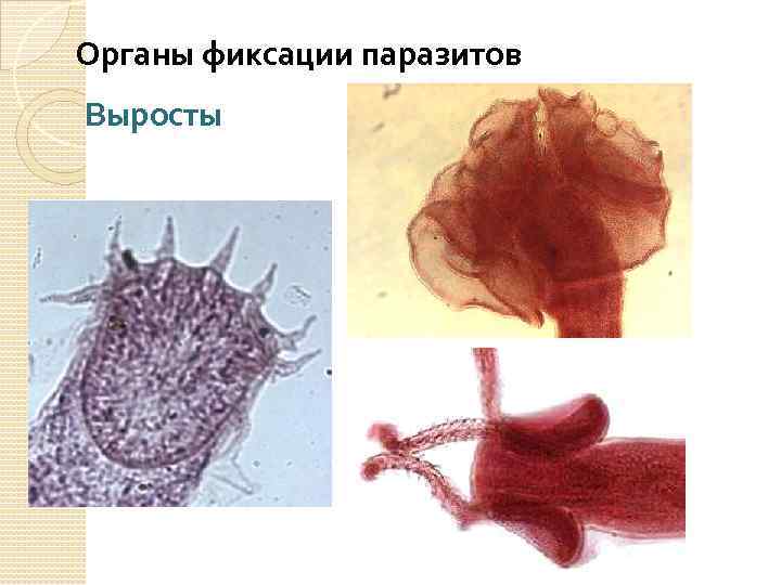 Органы фиксации паразитов Выросты 