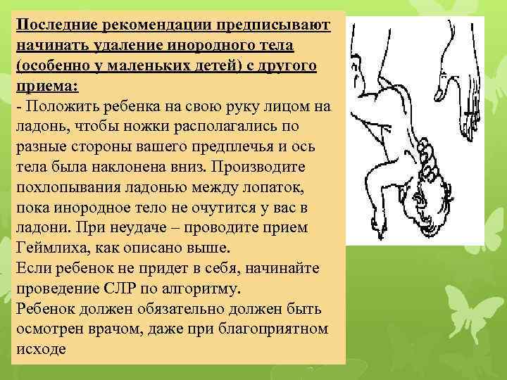 Последние рекомендации предписывают начинать удаление инородного тела (особенно у маленьких детей) с другого приема: