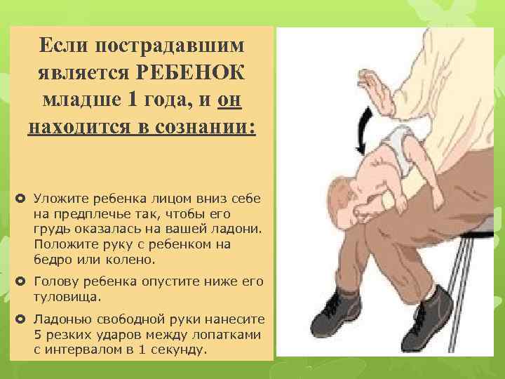 Если пострадавшим является РЕБЕНОК младше 1 года, и он находится в сознании: Уложите ребенка