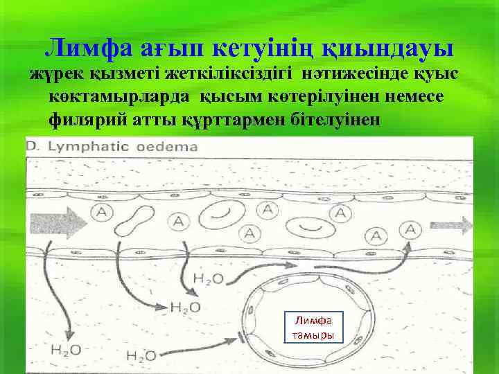 Лимфа ағып кетуінің қиындауы жүрек қызметі жеткіліксіздігі нәтижесінде қуыс көктамырларда қысым көтерілуінен немесе филярий