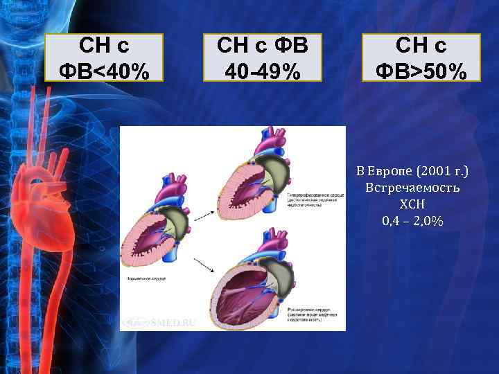 СН с ФВ<40% СН с ФВ 40 -49% СН с ФВ>50% В Европе (2001