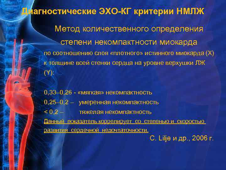 Диагностические ЭХО-КГ критерии НМЛЖ Метод количественного определения степени некомпактности миокарда по соотношению слоя «плотного»