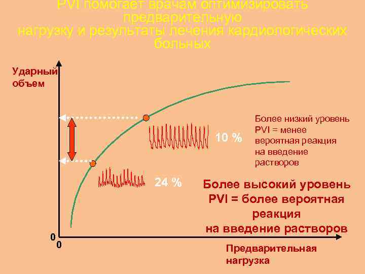 PVI помогает врачам оптимизировать предварительную нагрузку и результаты лечения кардиологических больных Ударный объем 10