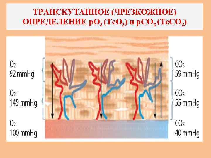 ТРАНСКУТАННОЕ (ЧРЕЗКОЖНОЕ) ОПРЕДЕЛЕНИЕ р. O 2 (Tс. О 2) и р. СО 2 (Tc.