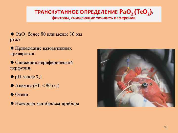 ТРАНСКУТАННОЕ ОПРЕДЕЛЕНИЕ Pa. O 2 (Tc. O 2): факторы, снижающие точность измерения l Pa.