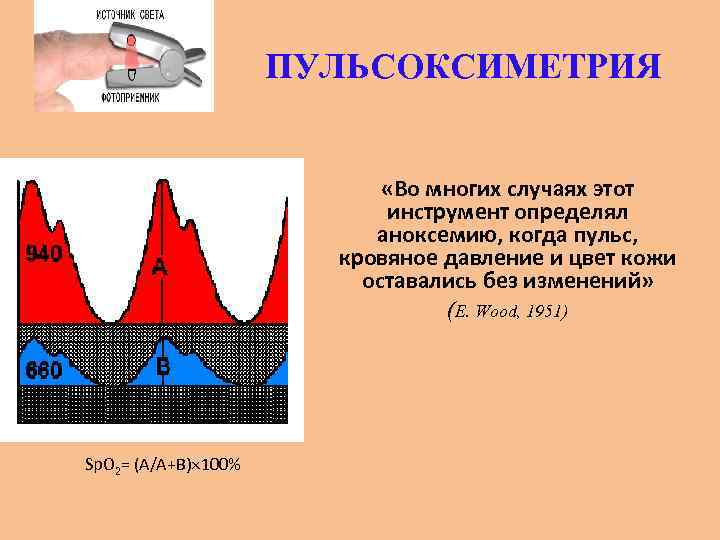 ПУЛЬСОКСИМЕТРИЯ «Во многих случаях этот инструмент определял аноксемию, когда пульс, кровяное давление и цвет