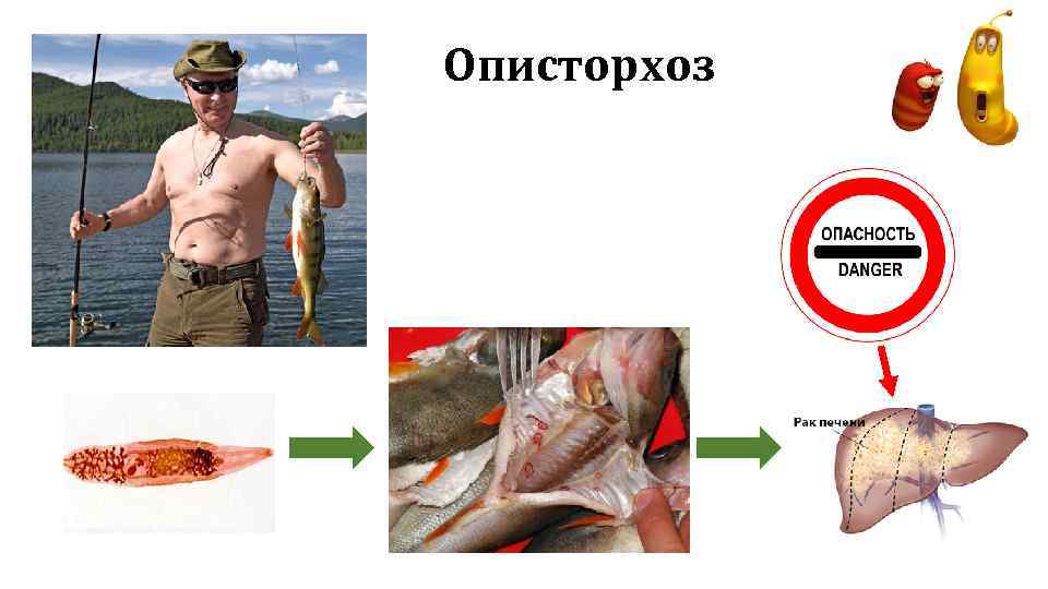 Описторхоз 