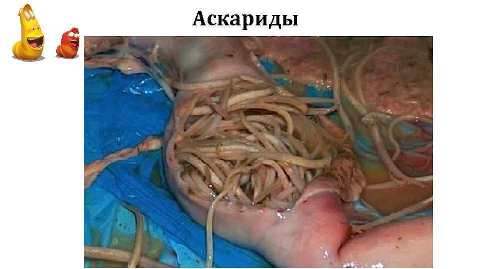 Аскариды 