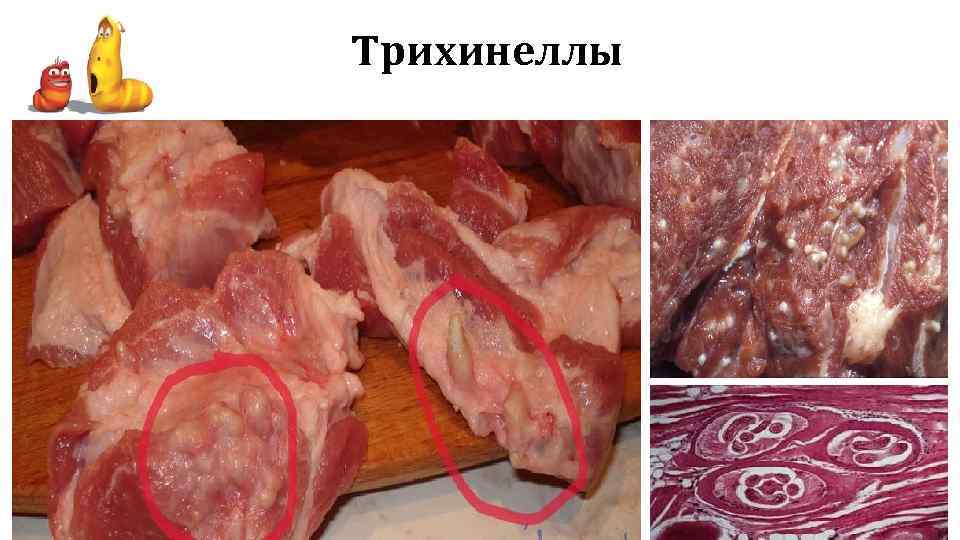 Трихинеллы 