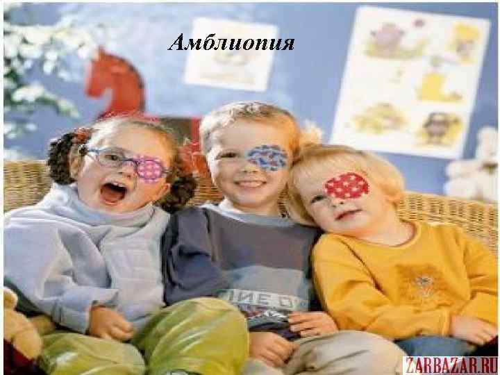 Амблиопия 