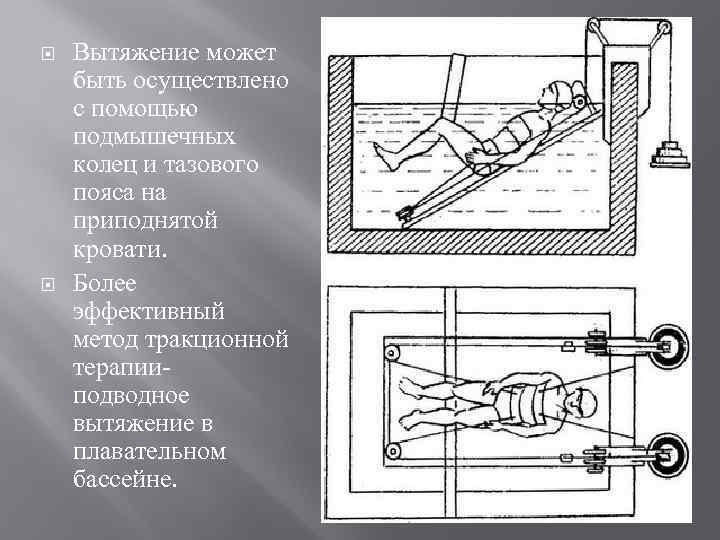  Вытяжение может быть осуществлено с помощью подмышечных колец и тазового пояса на приподнятой