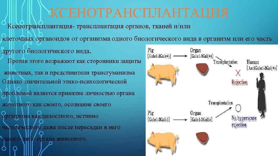 Отношение к трансплантации