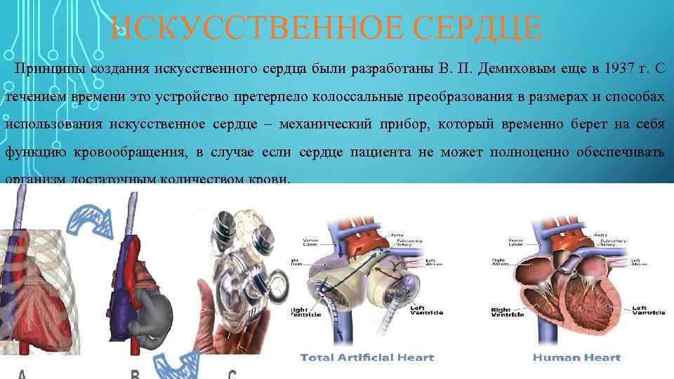 ИСКУССТВЕННОЕ СЕРДЦЕ Принципы создания искусственного сердца были разработаны В. П. Демиховым еще в 1937