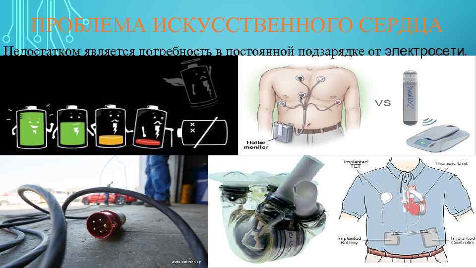 ПРОБЛЕМА ИСКУССТВЕННОГО СЕРДЦА Недостатком является потребность в постоянной подзарядке от электросети. 