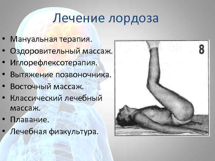 Лечение лордоза Мануальная терапия. Оздоровительный массаж. Иглорефлексотерапия. Вытяжение позвоночника. Восточный массаж. Классический лечебный массаж.