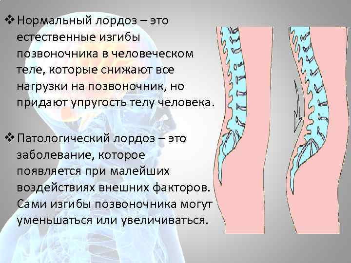 v Нормальный лордоз – это естественные изгибы позвоночника в человеческом теле, которые снижают все