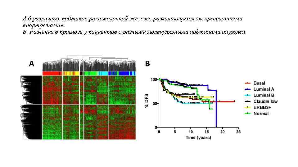 А 6 различных подтипов рака молочной железы, различающихся экспрессионными «портретами» . В. Различия в