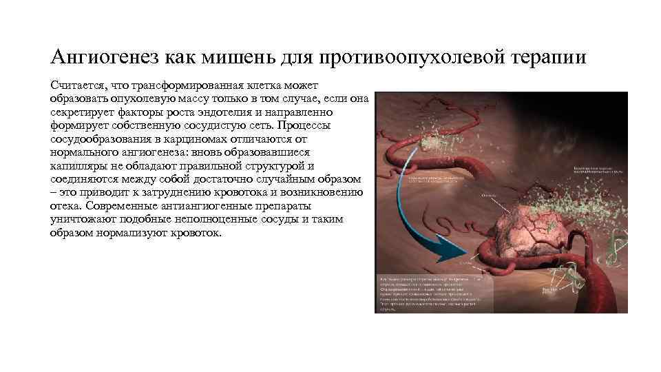 Ангиогенез как мишень для противоопухолевой терапии Считается, что трансформированная клетка может образовать опухолевую массу