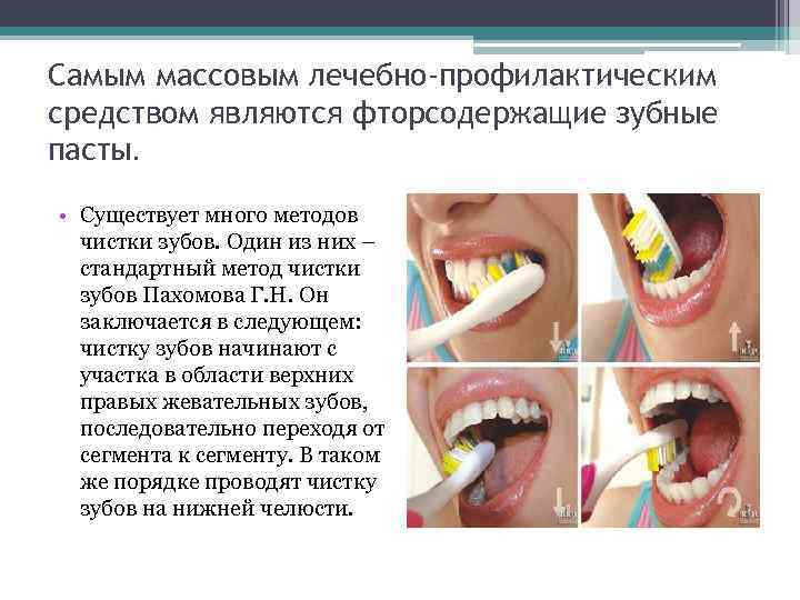 Самым массовым лечебно-профилактическим средством являются фторсодержащие зубные пасты.  • Существует много методов 