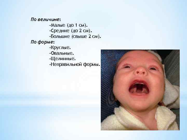 По величине:   -Малые (до 1 см).   -Средние (до 2 см).