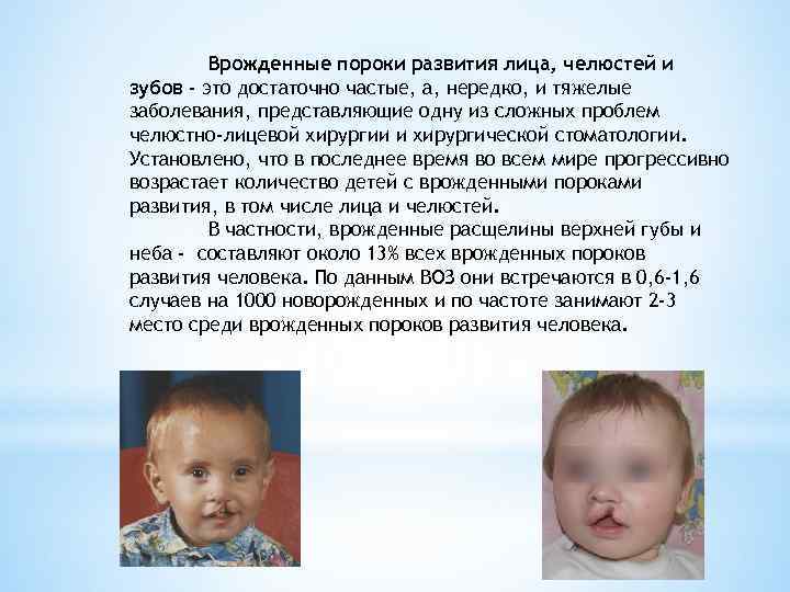    Врожденные пороки развития лица, челюстей и зубов - это достаточно частые,