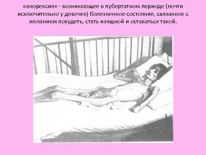 «анорексия» возникающее в пубертатном периоде (почти исключительно у девочек) болезненное состояние, «анорексия» возникающее в пубертатном периоде (почти исключительно у девочек) болезненное состояние,