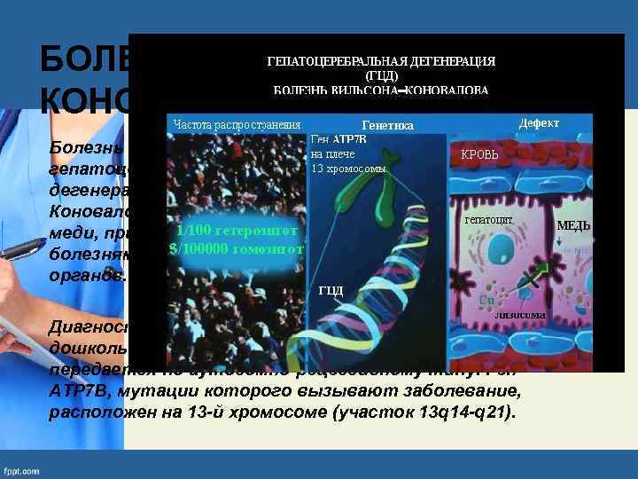 БОЛЕЗНЬ ВИЛЬСОНА — КОНОВАЛОВА Болезнь Вильсона (Болезнь Вильсона — Коновалова, гепатоцеребральная дистрофия, гепатолентикулярная дегенерация,