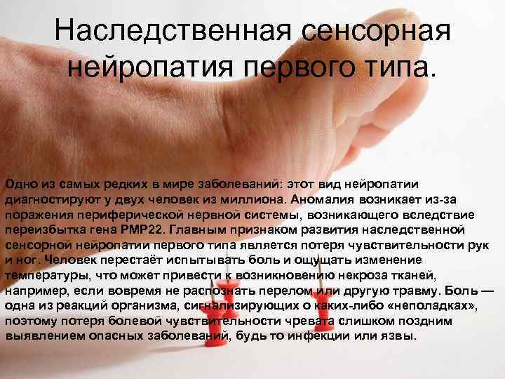  Наследственная сенсорная  нейропатия первого типа.  Одно из самых редких в мире