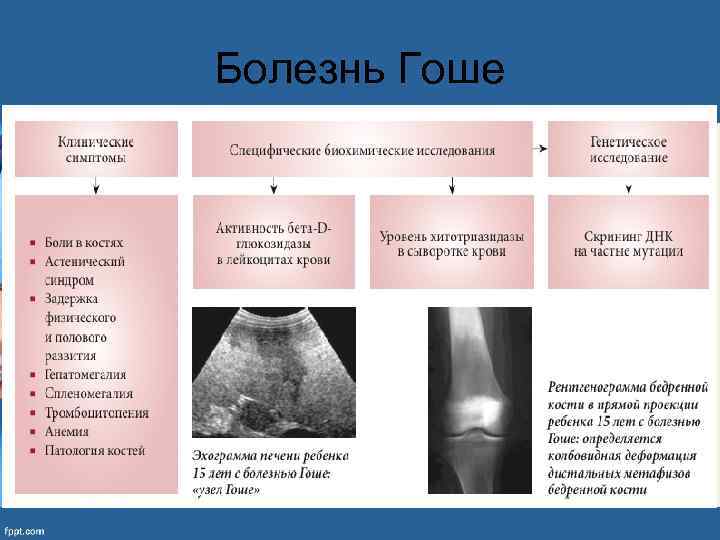 Болезнь Гоше 