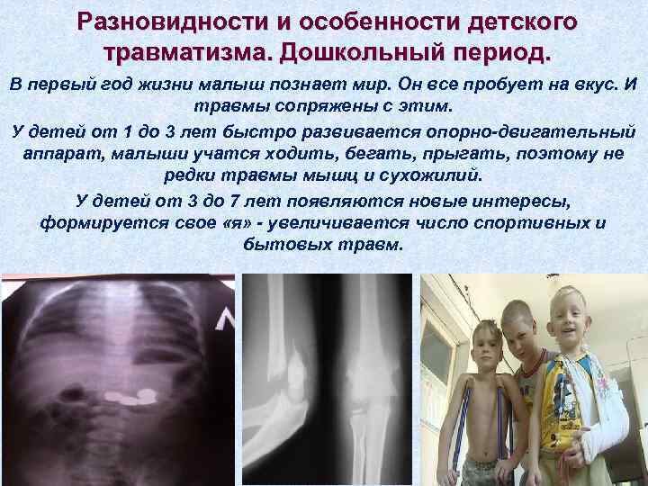  Разновидности и особенности детского   травматизма. Дошкольный период. В первый год жизни