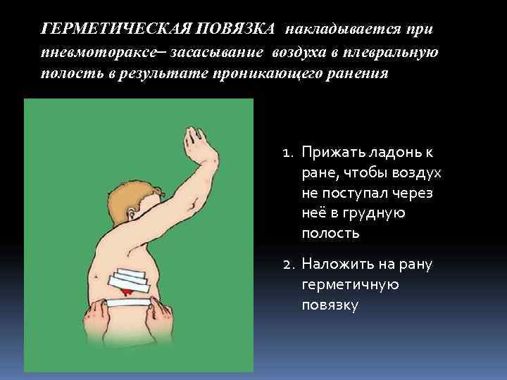 ГЕРМЕТИЧЕСКАЯ ПОВЯЗКА накладывается при пневмотораксе– засасывание воздуха в плевральную полость в результате проникающего ранения