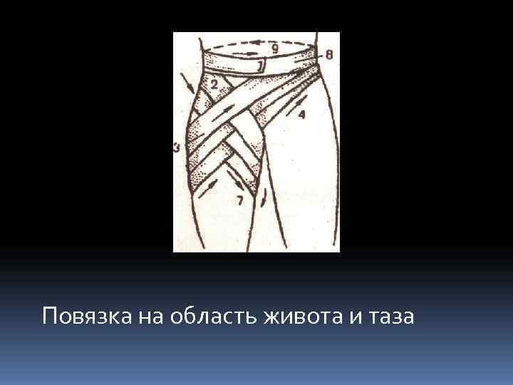Повязка на область живота и таза 