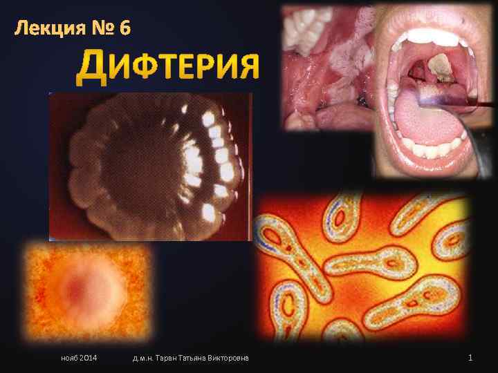 Лекция № 6  нояб 2014  д. м. н. Таран Татьяна Викторовна 