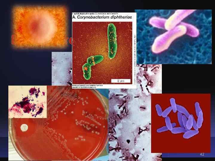 Возбудитель дифтерии  нояб 2014  д. м. н. Таран Татьяна Викторовна  42