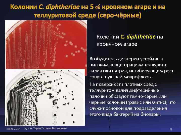      Колонии C. diphtheriae на     кровяном